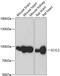 SCY1 Like Pseudokinase 2 antibody, GTX66174, GeneTex, Western Blot image 