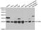 Deoxythymidylate Kinase antibody, STJ28453, St John