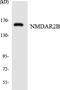 NMDAR2B antibody, LS-C200274, Lifespan Biosciences, Western Blot image 