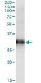 Homeobox B9 antibody, H00003219-M05, Novus Biologicals, Western Blot image 