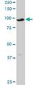 Lysine Acetyltransferase 2A antibody, H00002648-M03, Novus Biologicals, Western Blot image 