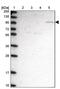 Chloride Voltage-Gated Channel 3 antibody, PA5-60802, Invitrogen Antibodies, Western Blot image 