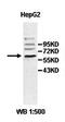 Zinc Finger Protein 155 antibody, orb77974, Biorbyt, Western Blot image 