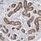 Mitochondrial Trans-2-Enoyl-CoA Reductase antibody, NBP1-85657, Novus Biologicals, Immunohistochemistry frozen image 