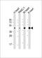 Wnt Family Member 5A antibody, 62-006, ProSci, Western Blot image 