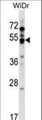 G Protein-Coupled Receptor 84 antibody, LS-C159777, Lifespan Biosciences, Western Blot image 