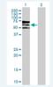Phosphoinositide Kinase, FYVE-Type Zinc Finger Containing antibody, H00200576-B02P-50ug, Novus Biologicals, Western Blot image 