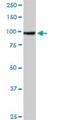 TNNI3 Interacting Kinase antibody, H00051086-D01P, Novus Biologicals, Western Blot image 