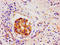 Lin-28 Homolog A antibody, LS-C673173, Lifespan Biosciences, Immunohistochemistry paraffin image 