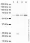 Small Nuclear Ribonucleoprotein U1 Subunit 70 antibody, ab83306, Abcam, Western Blot image 