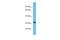 Olfactory Receptor Family 5 Subfamily J Member 2 antibody, A18798, Boster Biological Technology, Western Blot image 