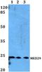 Mediator Complex Subunit 29 antibody, A10590, Boster Biological Technology, Western Blot image 