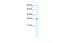 Chloride Intracellular Channel 5 antibody, PA5-41047, Invitrogen Antibodies, Western Blot image 