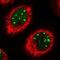 Transducin Beta Like 3 antibody, NBP1-92481, Novus Biologicals, Immunocytochemistry image 