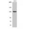 Histone Deacetylase 6 antibody, LS-C383910, Lifespan Biosciences, Western Blot image 