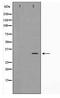 Forkhead Box E1 antibody, TA347768, Origene, Western Blot image 