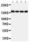 MER Proto-Oncogene, Tyrosine Kinase antibody, LS-C313372, Lifespan Biosciences, Western Blot image 