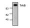 BDNF/NT-3 growth factors receptor antibody, AP00264PU-N, Origene, Western Blot image 