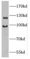Guanylate Cyclase 2D, Retinal antibody, FNab03728, FineTest, Western Blot image 