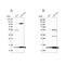 TRNA Methyltransferase Subunit 11-2 antibody, PA5-58971, Invitrogen Antibodies, Western Blot image 