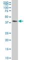 NFKB Inhibitor Beta antibody, H00004793-M03, Novus Biologicals, Western Blot image 