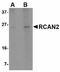 Regulator Of Calcineurin 2 antibody, LS-B4820, Lifespan Biosciences, Western Blot image 