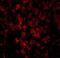 DNA Damage Regulated Autophagy Modulator 1 antibody, GTX85484, GeneTex, Immunohistochemistry paraffin image 