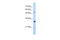 Proteasome Activator Subunit 3 antibody, 30-167, ProSci, Western Blot image 