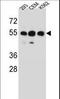 Zinc Finger Protein 562 antibody, LS-C160905, Lifespan Biosciences, Western Blot image 