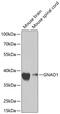 G Protein Subunit Alpha O1 antibody, GTX55644, GeneTex, Western Blot image 