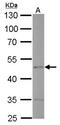 Endothelin Receptor Type B antibody, NBP1-31108, Novus Biologicals, Western Blot image 