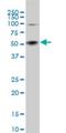 Serum/Glucocorticoid Regulated Kinase 2 antibody, H00010110-M07, Novus Biologicals, Western Blot image 