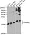 Cytosolic Iron-Sulfur Assembly Component 2B antibody, GTX32597, GeneTex, Western Blot image 