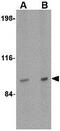 SATB Homeobox 2 antibody, GTX31773, GeneTex, Western Blot image 