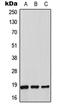 Thioredoxin 2 antibody, LS-C353381, Lifespan Biosciences, Western Blot image 