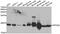 Protein Phosphatase 3 Regulatory Subunit B, Beta antibody, A11564, Boster Biological Technology, Western Blot image 