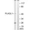PLAG1 Like Zinc Finger 1 antibody, PA5-50173, Invitrogen Antibodies, Western Blot image 
