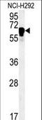 Tetratricopeptide repeat protein 26 antibody, LS-C160296, Lifespan Biosciences, Western Blot image 