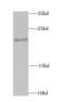 MYC Associated Factor X antibody, FNab05033, FineTest, Western Blot image 