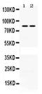 Phospholipase A2 Group IVA antibody, PB9778, Boster Biological Technology, Western Blot image 