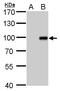Kruppel Like Factor 10 antibody, GTX108661, GeneTex, Western Blot image 