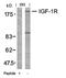 Insulin Like Growth Factor 1 antibody, orb14493, Biorbyt, Western Blot image 