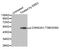 Casein Kinase 2 Alpha 1 antibody, STJ22081, St John