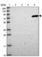 Propionyl-CoA Carboxylase Subunit Alpha antibody, PA5-61590, Invitrogen Antibodies, Western Blot image 