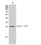 BCL2 antibody, STJ90652, St John
