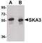 Spindle And Kinetochore Associated Complex Subunit 3 antibody, PA5-20819, Invitrogen Antibodies, Western Blot image 