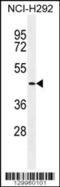 Transmembrane Serine Protease 11E antibody, 56-120, ProSci, Western Blot image 