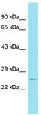 Transmembrane Protein 174 antibody, TA333469, Origene, Western Blot image 