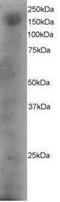 Dedicator Of Cytokinesis 1 antibody, NB100-828, Novus Biologicals, Western Blot image 