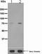 Mitogen-Activated Protein Kinase Kinase Kinase 7 antibody, ab109404, Abcam, Western Blot image 